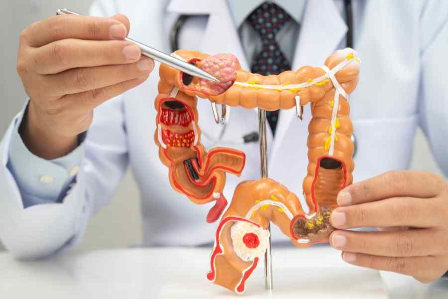 95% of patients with advanced colorectal cancer will detect MSS, how to treat it?